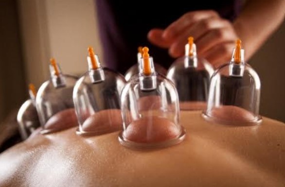 massage cupping